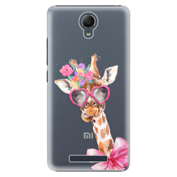 Plastové puzdro iSaprio - Lady Giraffe - Xiaomi Redmi Note 2